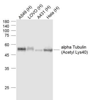 Alpha Tubulin (Acetyl Lys40) antibody
