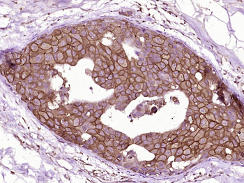 C-erbB-2/HER2 Mouse Monoclonal Antibody