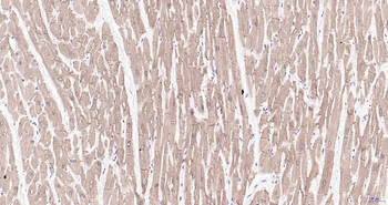 HSP22 Mouse Monoclonal Antibody
