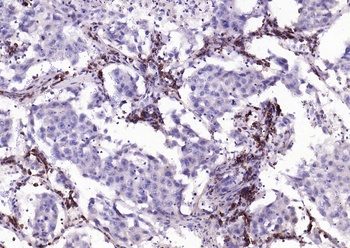 PTEN (phospho-Ser380) antibody