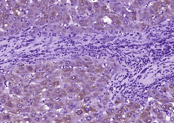 SOD2 Mouse Monoclonal Antibody