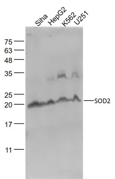 SOD2 antibody