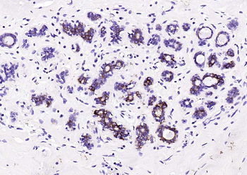 FASN Mouse Monoclonal Antibody