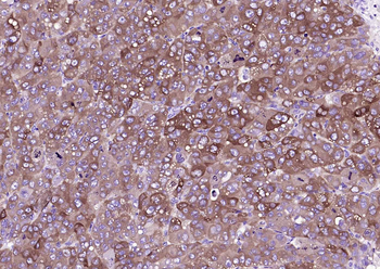 FASN Mouse Monoclonal Antibody