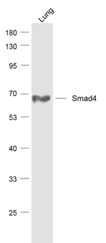 Smad4 Recombinant Rabbit Monoclonal Antibody
