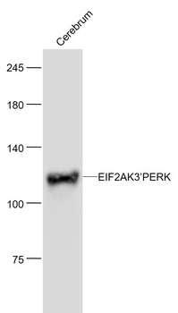 EIF2AK3RK antibody