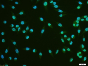 Phospho-STAT3 (Ser727) Recombinant Rabbit Monoclonal Antibody