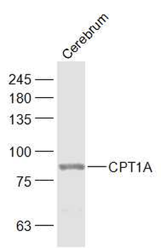 CPT1A Rabbit Polyclonal Antibody