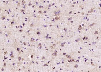 Somatostatin Rabbit Polyclonal Antibody