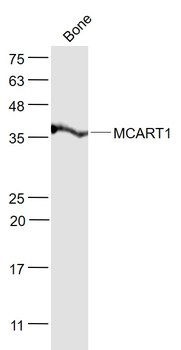 MCART1 Rabbit Polyclonal Antibody