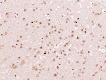 Phospho-p38 MAPK (Tyr323) Rabbit Polyclonal Antibody