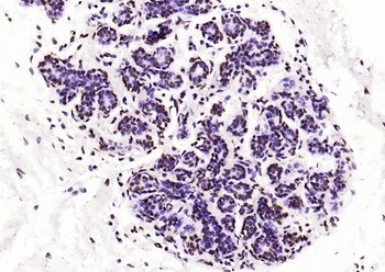 Histone H3 (di methyl K36) Mouse Monoclonal Antibody