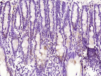 RNF111 Rabbit Polyclonal Antibody