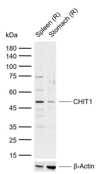 CHIT1 Rabbit Polyclonal Antibody