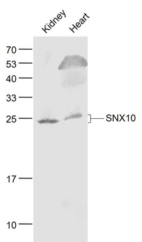 SNX10 antibody