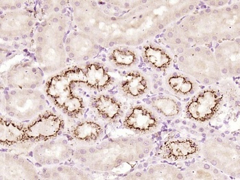 Cystatin-C antibody