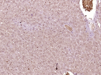 SAMD11 Rabbit Polyclonal Antibody