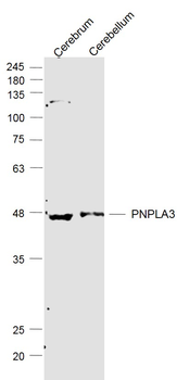 PNPLA3 Rabbit Polyclonal Antibody