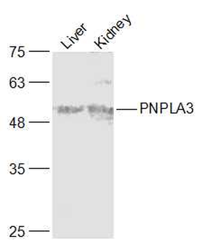 PNPLA3 Rabbit Polyclonal Antibody