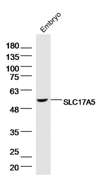 SLC17A5 Rabbit Polyclonal Antibody