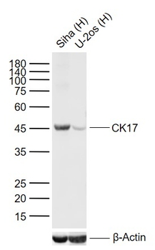 CK17 Mouse Monoclonal Antibody