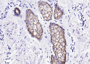 CK17 Mouse Monoclonal Antibody