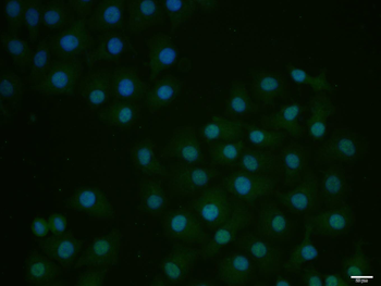 E2F1 Rabbit Polyclonal Antibody