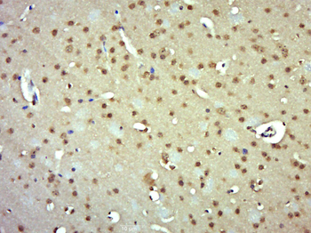 E2F1 Rabbit Polyclonal Antibody