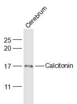 Calcitonin antibody