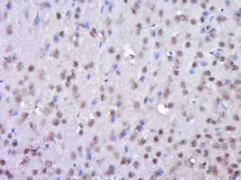 FSCB Rabbit Polyclonal Antibody