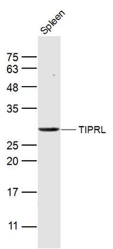 TIPRL Rabbit Polyclonal Antibody