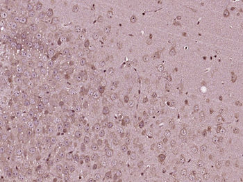 PRMT2 Rabbit Polyclonal Antibody