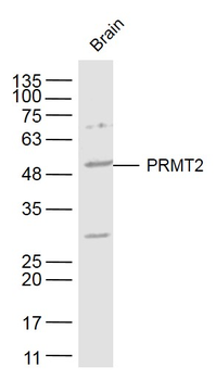 PRMT2 Rabbit Polyclonal Antibody