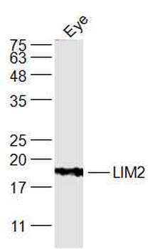 LIM2 Rabbit Polyclonal Antibody