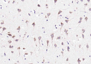 Beta Amyloid 1-16 Mouse Polyclonal Antibody