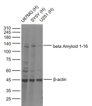 Beta Amyloid 1-16 antibody