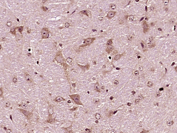 IL-6R alpha Rabbit Polyclonal Antibody