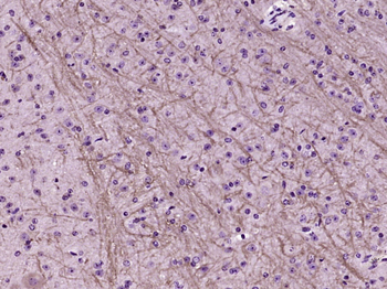 NMDAR1 Rabbit Polyclonal Antibody