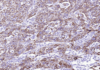 CK16 Mouse Monoclonal Antibody