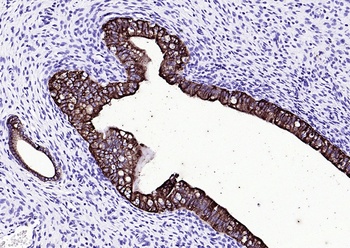 CK16 antibody