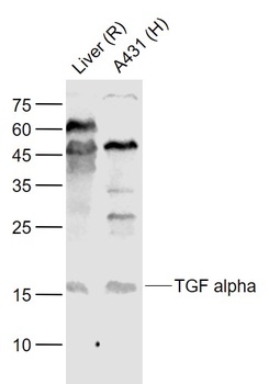 TGF Alpha antibody
