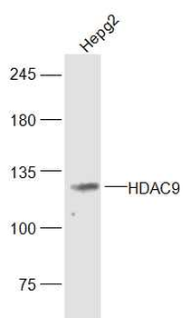 HDAC9 Rabbit Polyclonal Antibody