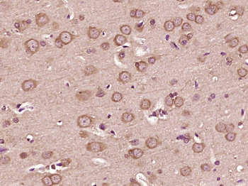 VEGFA Rabbit Polyclonal Antibody