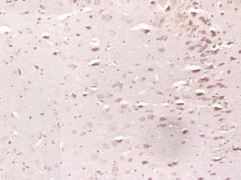 Synaptopodin Rabbit Polyclonal Antibody