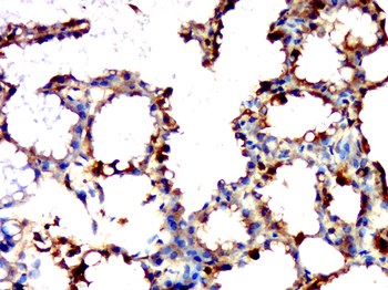 GP1BA Rabbit Polyclonal Antibody