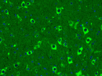 Somatostatin 14 Rabbit Polyclonal Antibody