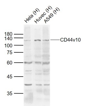 CD44v10 antibody