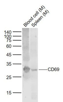 CD69 Rabbit Polyclonal Antibody