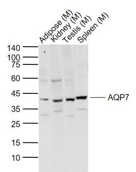 AQP7 Rabbit Polyclonal Antibody