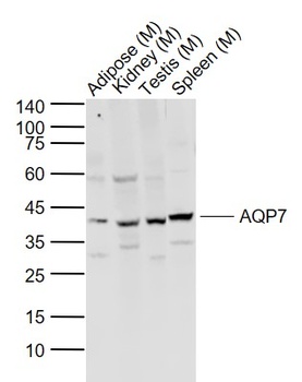 AQP7 antibody